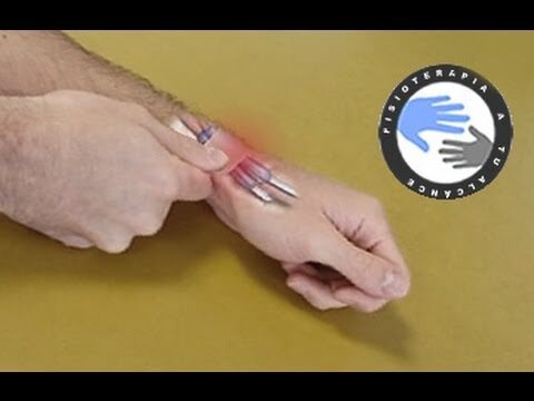 Consejos efectivos para reducir un tendón inflamado