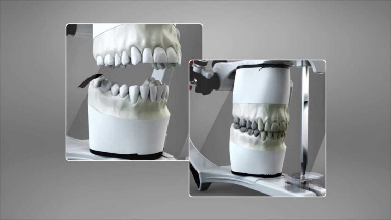 Guía para montar un articulador dental paso a paso